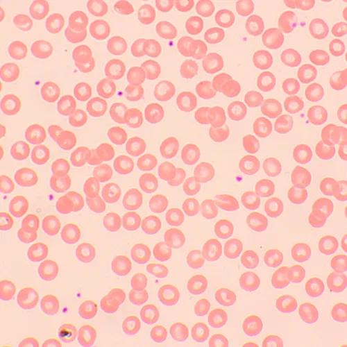 fotografie biologický digitální mikroskop MAGUS Bio D250TL LCD,  29