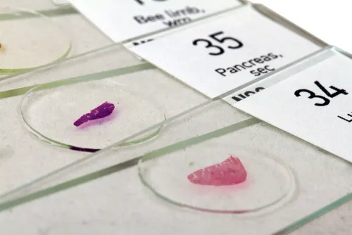 fotografie sada preparátů a sklíček Levenhuk N80 NG "Uvidět vše",  6