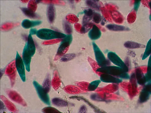 snímek sada preparátů připravených k pozorování mikroskopem Levenhuk N18 NG,  10