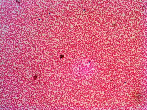 obrázek sada preparátů připravených k pozorování mikroskopem Levenhuk N38 NG,  16