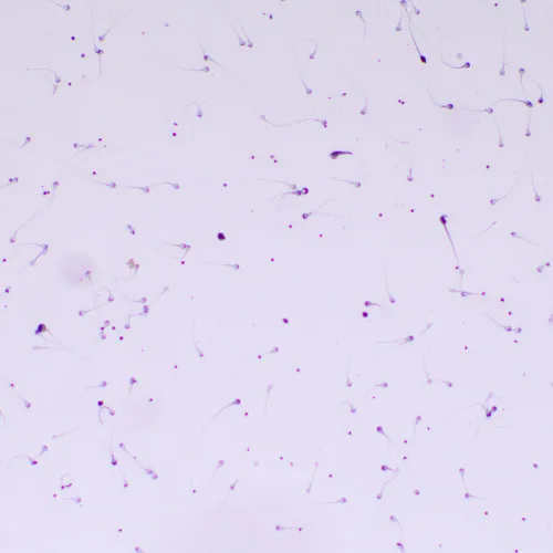 fotografie biologický digitální mikroskop MAGUS Bio D260T LCD,  29